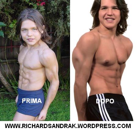 Richard Sandrak Prima e Dopo (Before & Now)2